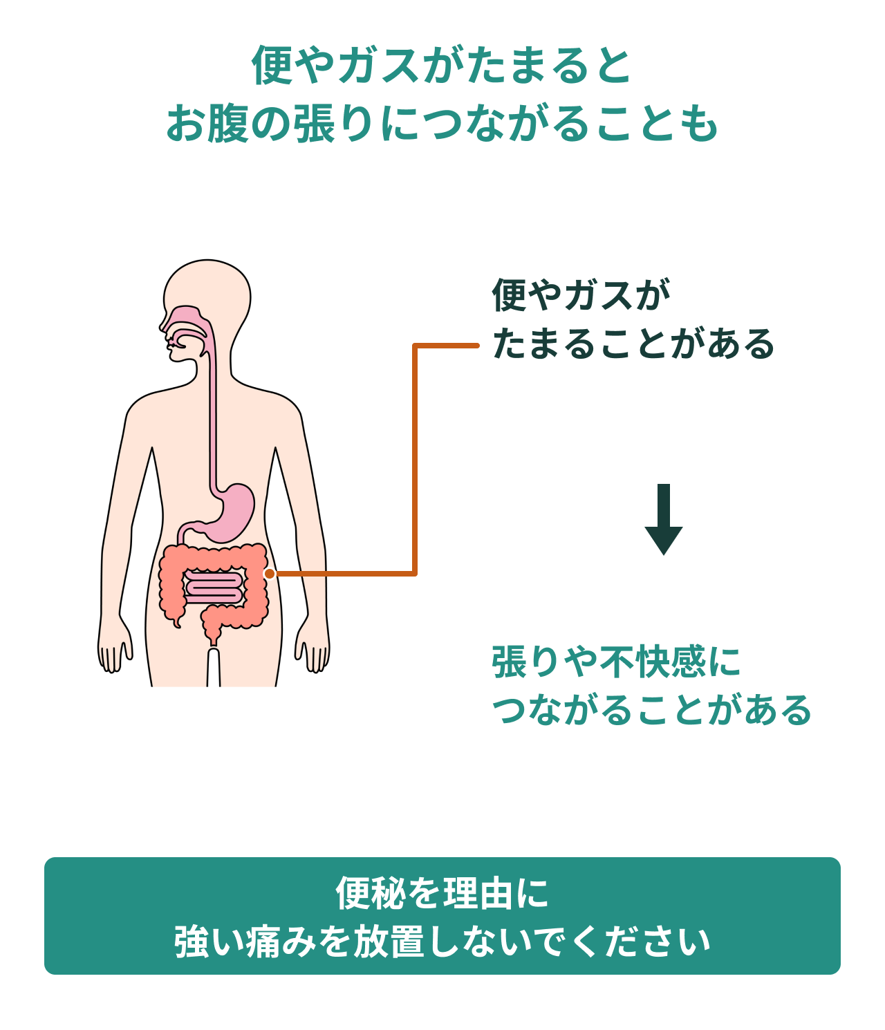 腸の張りとお腹の不快感。便やガスがたまると張りや不快感につながることがあります。便秘を理由に強い痛みを放置しないでください。