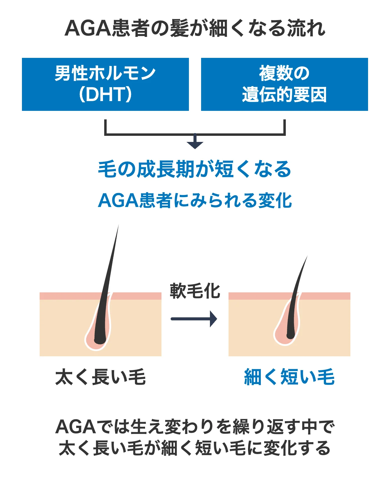 AGAで髪が細くなる仕組み
