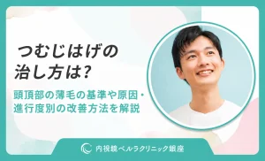 つむじはげの治し方は？頭頂部の薄毛の基準や原因・進行度別の改善方法を解説
