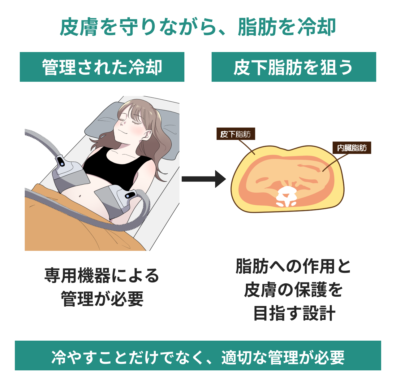 皮膚を守りながら脂肪を冷却する設計。施術イラストと腹部断面で、専用機器による管理の必要性と、皮下脂肪への作用・皮膚保護を目指す設計意図を説明。凍傷などのリスクがなくなることを示す図ではありません。