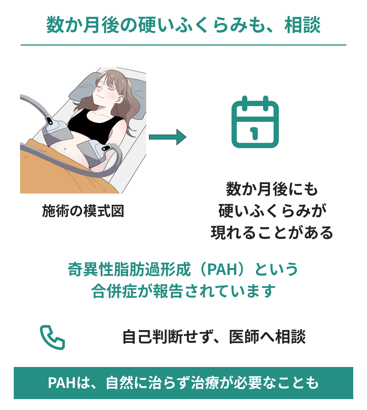 数か月後に現れる硬いふくらみも医師へ相談する図。脂肪冷却の施術の模式図からカレンダーへつなぎ、奇異性脂肪過形成（PAH）が報告され、自然に治らず治療が必要なこともあると説明。左のイラストは施術の模式図で、PAHの症状画像ではありません。