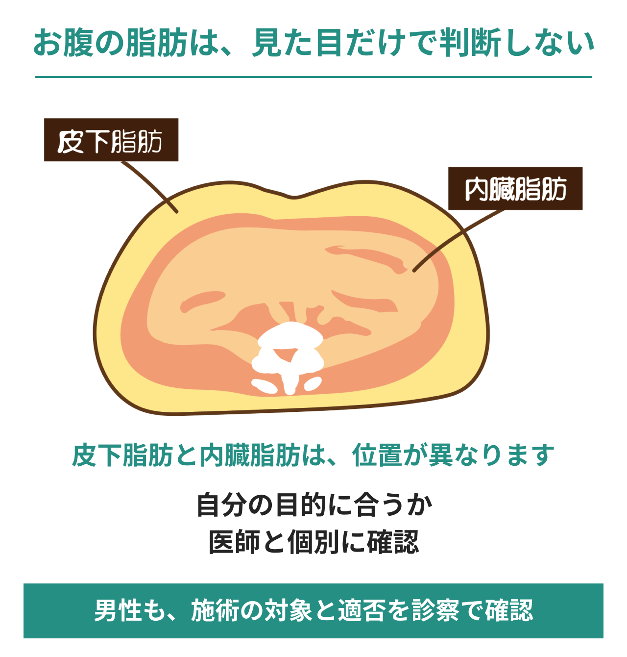 お腹の脂肪は見た目だけで判断しないことを示す腹部断面。皮下脂肪と内臓脂肪の位置の違い、目的に合うかを医師と個別に確認し、男性も施術の対象と適否を診察で確認することを説明。