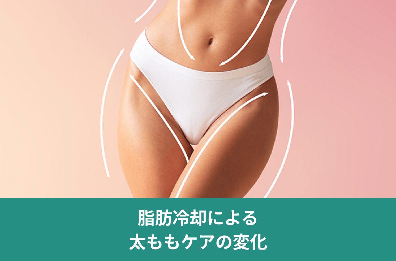 脂肪冷却による太ももケアの変化。腹部から太ももにかけて白い曲線を重ねた画像。